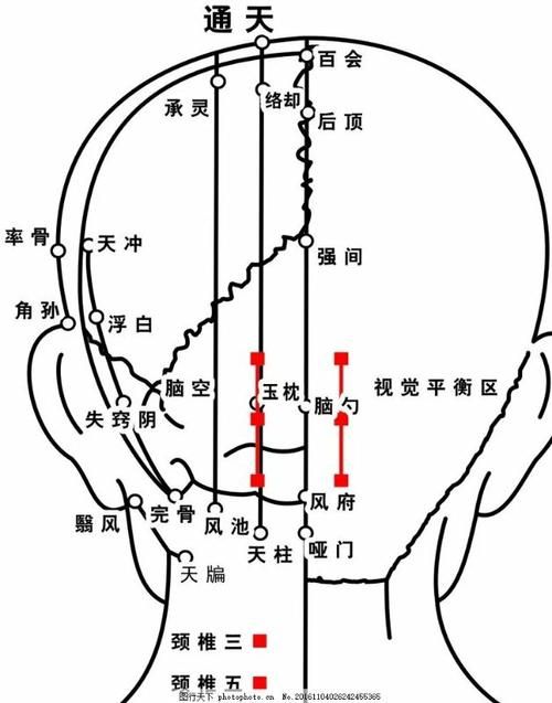 侠客风云传金翅鸟血位置要先走到树左边触发剧情吗