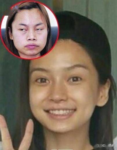 亚洲最丑明星引争议：评选标准引网友热议不断