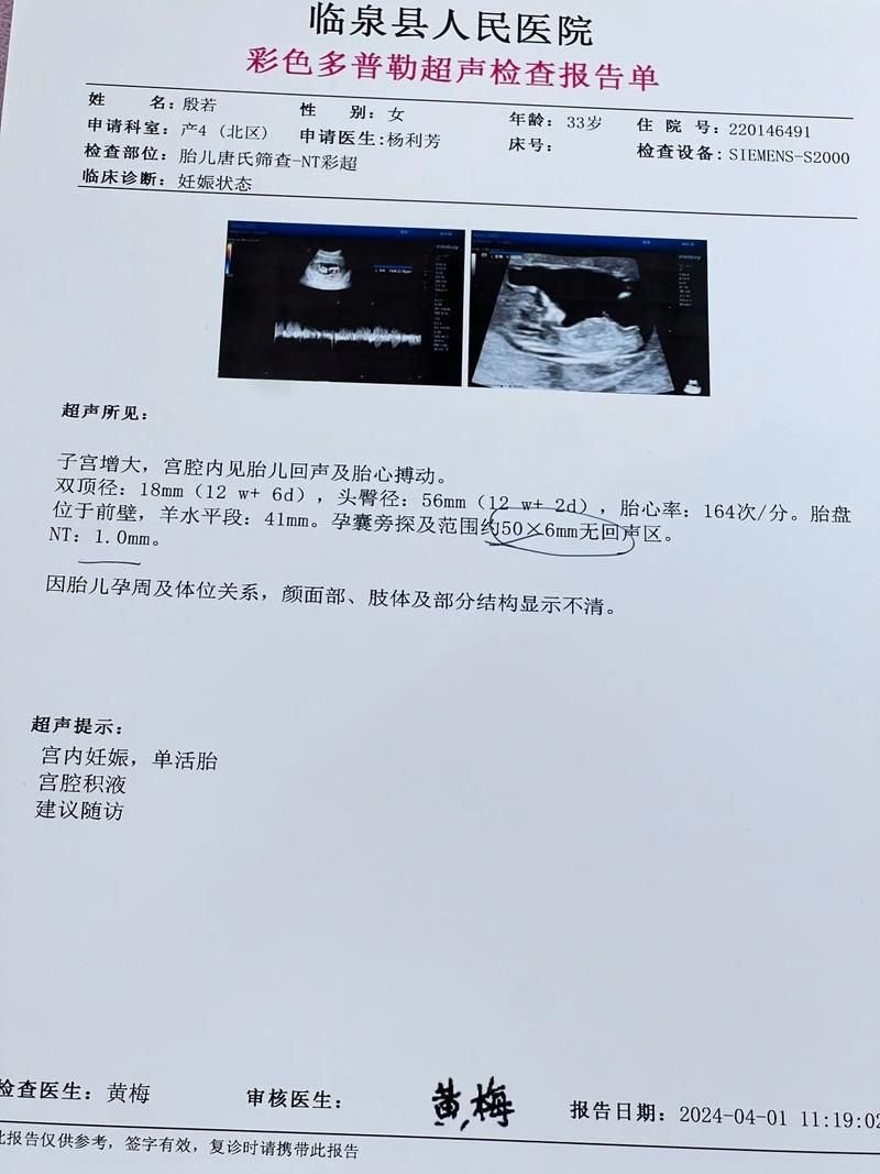 游戏里总说nt是什么？看完这篇你就懂了！