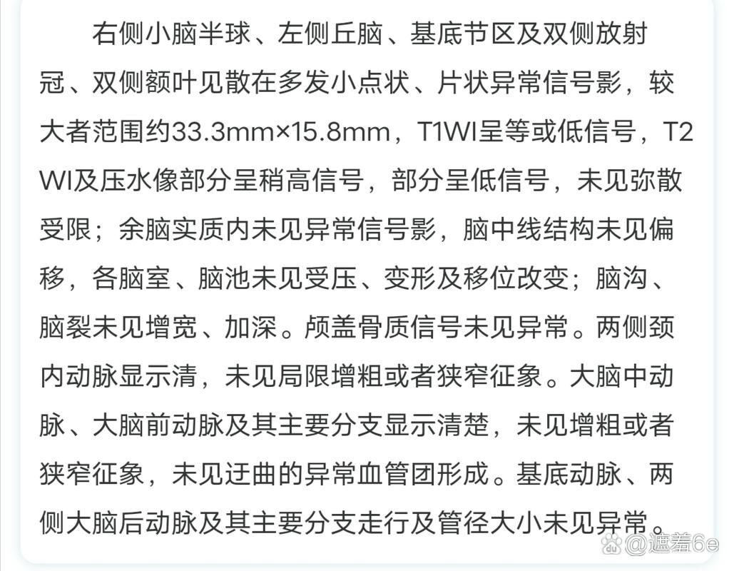 脑裂游戏对大脑好不好？这篇文章告诉你答案！