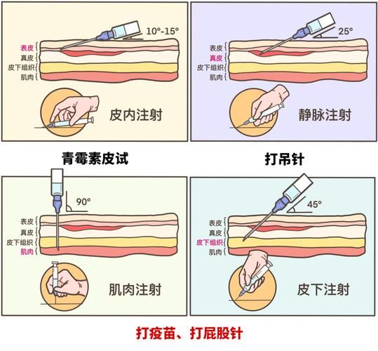 跟小美医生学打针游戏怎么玩？手把手教你成为高手！