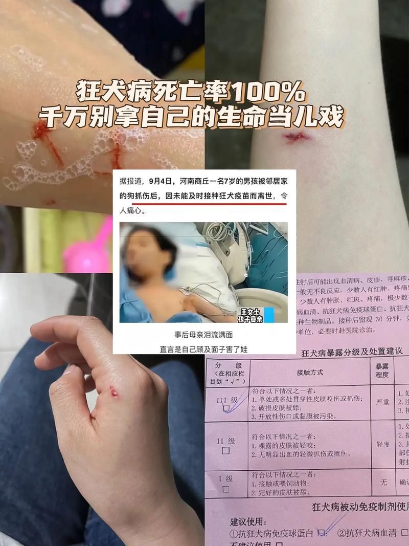 青少年打游戏猝死案例：玩游戏要注意啥？别拿命开玩笑！